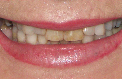 Cosmetic Before 3