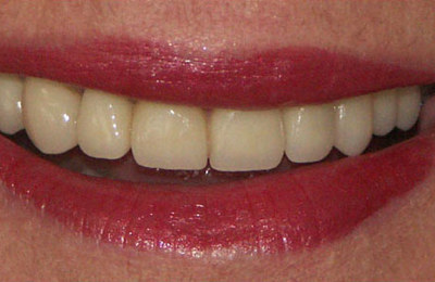 Cosmetic After 4