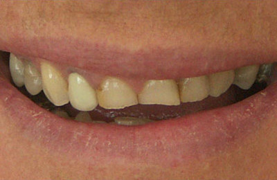 Cosmetic Before 4