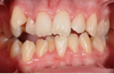M B Beforeafter 09