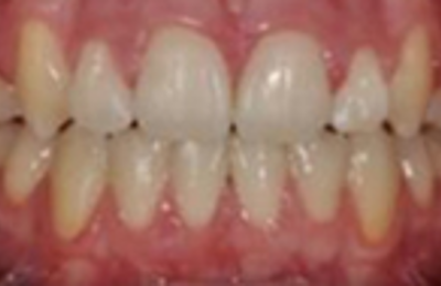 M B Beforeafter 18