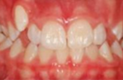 M B Beforeafter 23