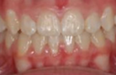 M B Beforeafter 24